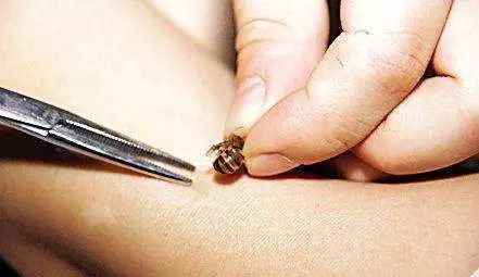 黃蜂的毒液是酸性還是堿性（黃蜂毒液性狀和被蟄后的應(yīng)急處理）